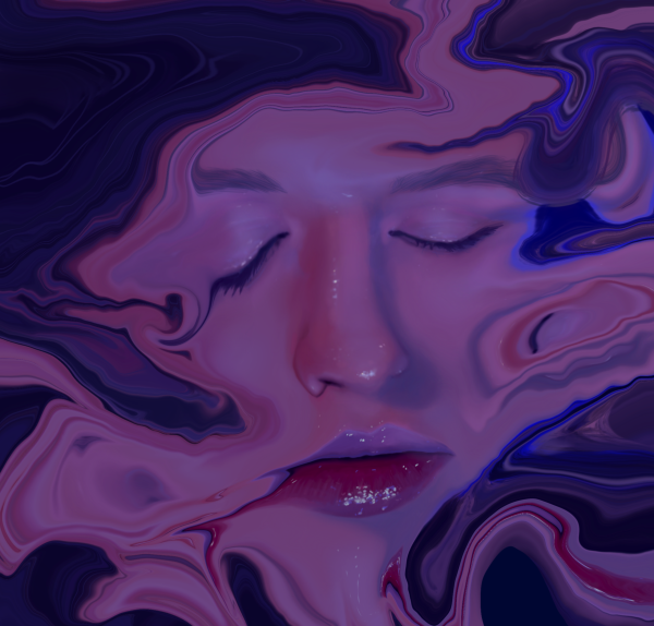 Distorsión V